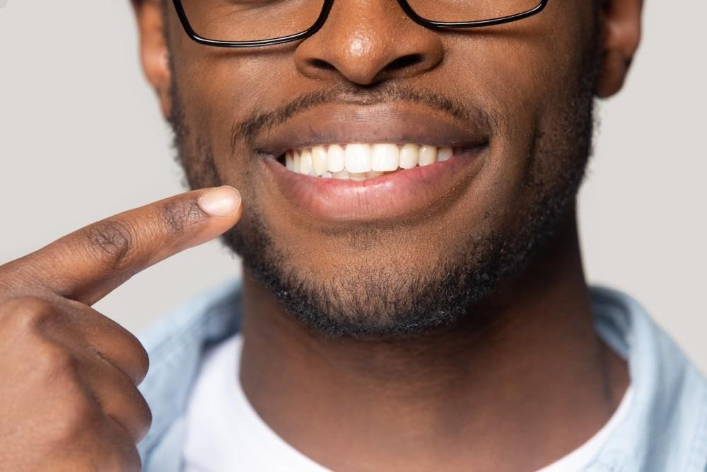 Fixing a gummy smile with veneers at Bayside Dental Arts in Queens