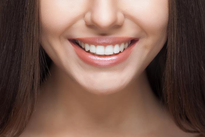 All-On-Four dental implants at Bayside Dental Arts in Queens