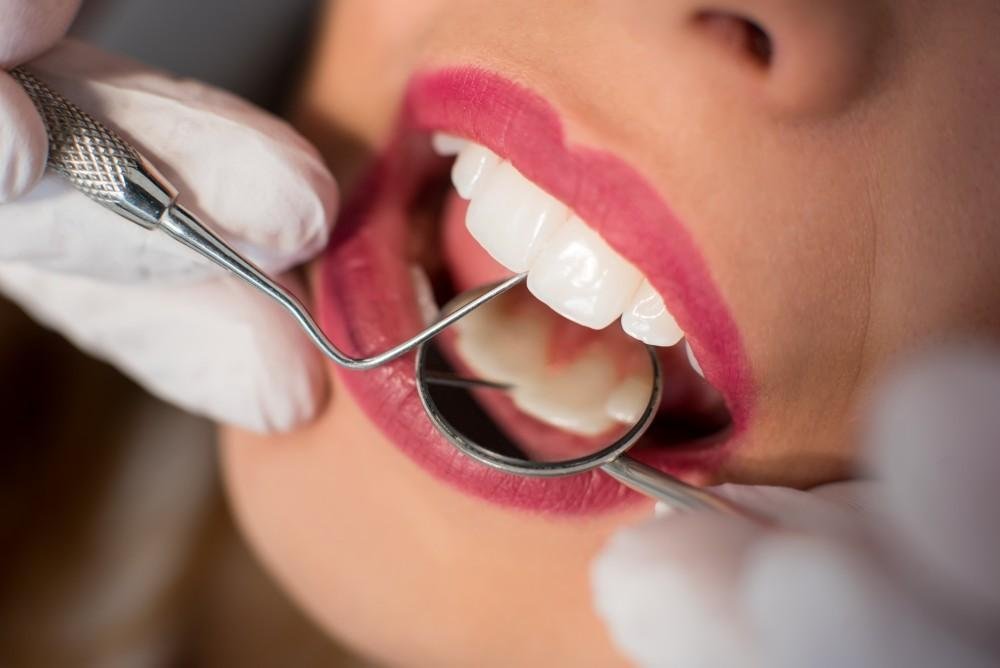 Emergency dentist open on Sunday in Queens - Bayside Dental Arts