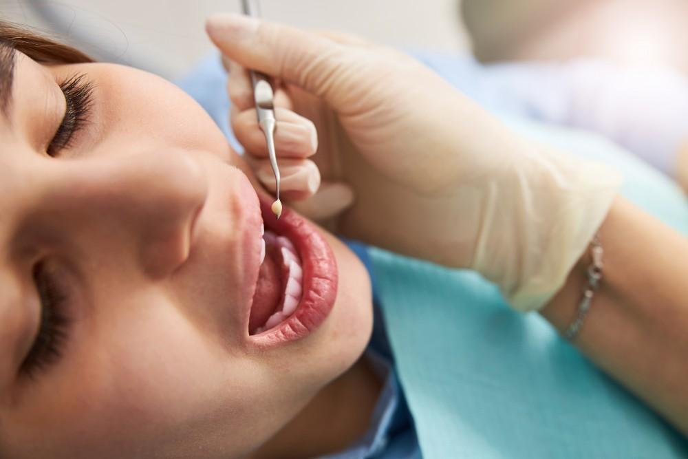 Safe mercury filling removal at Bayside Dental Arts