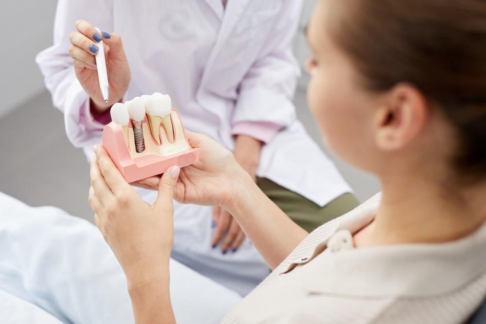 Implants or dental bridge comparison at Bayside Dental Arts